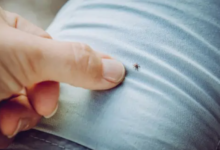Can Bedbugs Live in Your Clothes? Prevention Tips