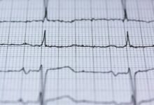 fusion summit digital pulse